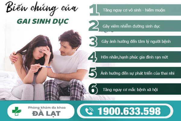 Hình ảnh minh họa